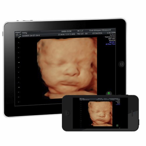 Baby Live Webstreaming - FREE